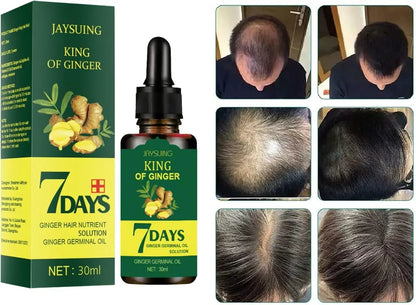 🚀 ACTIVA EL CRECIMIENTO NATURAL DE TU CABELLO HOY MISMO 🌱 – SIN QUÍMICOS, SIN EXCUSAS