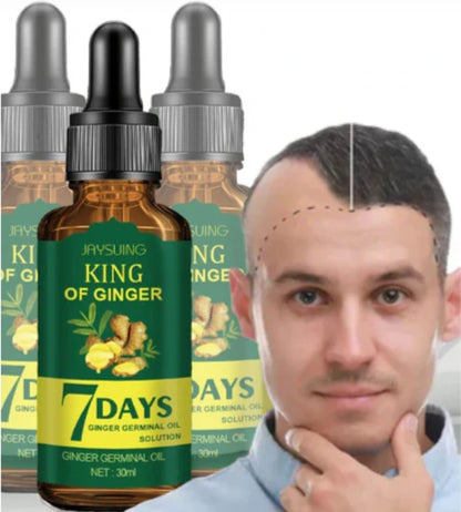 🚀 ACTIVA EL CRECIMIENTO NATURAL DE TU CABELLO HOY MISMO 🌱 – SIN QUÍMICOS, SIN EXCUSAS