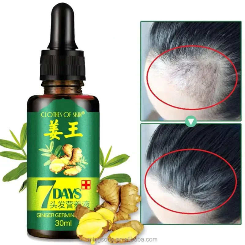 🚀 ACTIVA EL CRECIMIENTO NATURAL DE TU CABELLO HOY MISMO 🌱 – SIN QUÍMICOS, SIN EXCUSAS