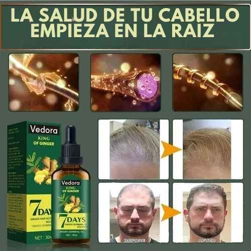 🚀 ACTIVA EL CRECIMIENTO NATURAL DE TU CABELLO HOY MISMO 🌱 – SIN QUÍMICOS, SIN EXCUSAS